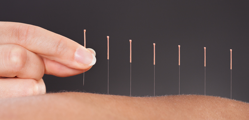 aiguilles d'acupuncture sur le bras