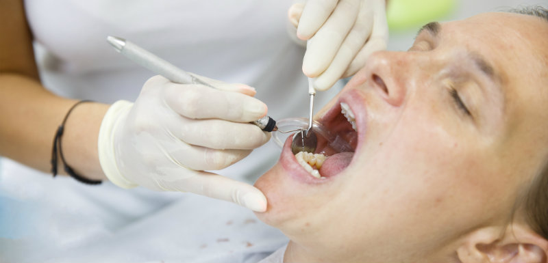 Diabète : traiter la parodontite présente plus d’un avantage !